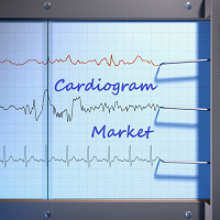 MT4-Cardiogram Market
